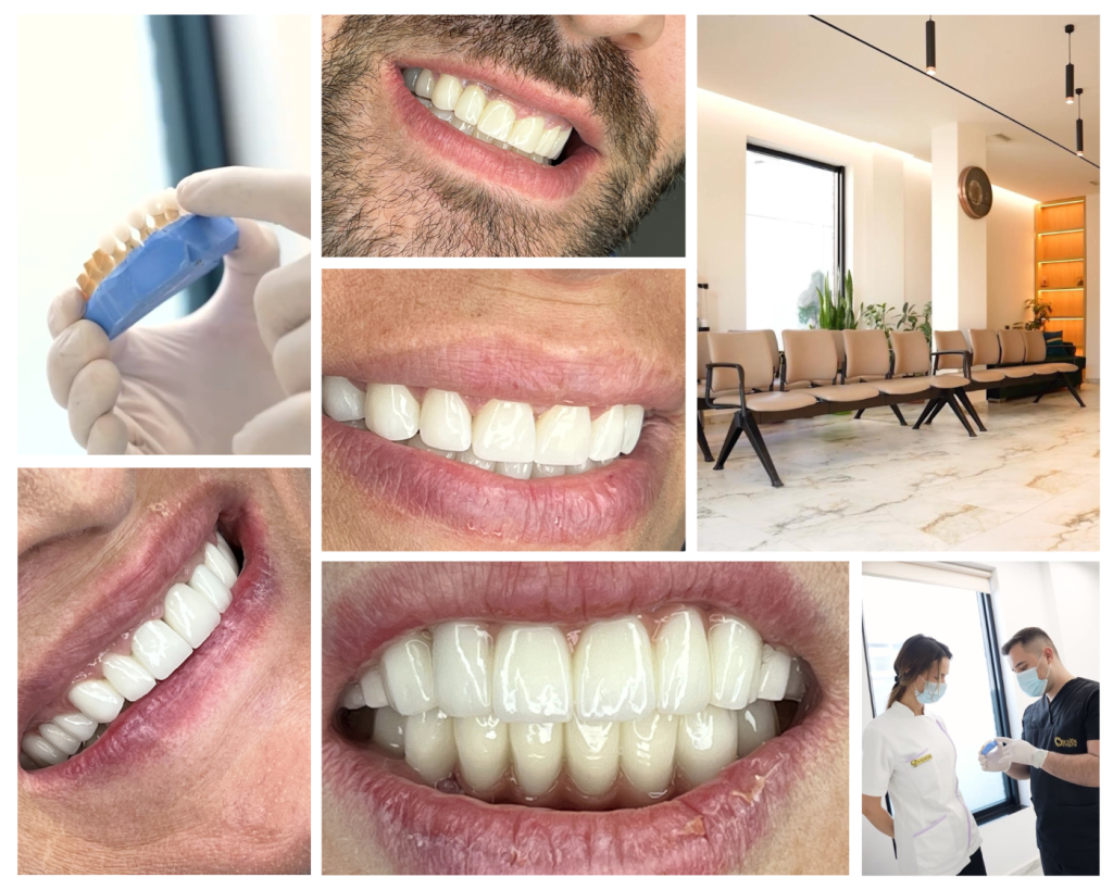 Turismo dentale in Albania