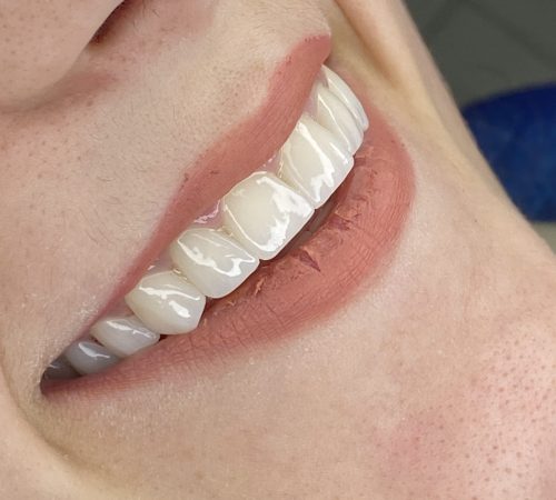 image00013 turismo dentale in albania