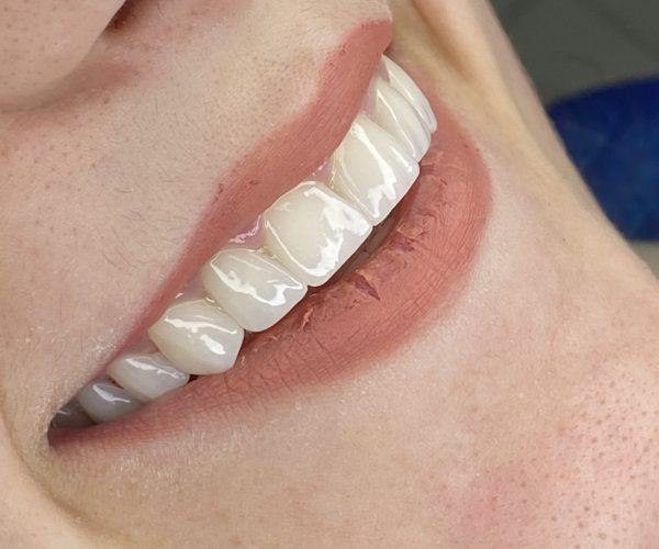 turismo dentale in albania