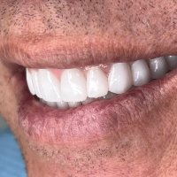 turismo dentale in albania